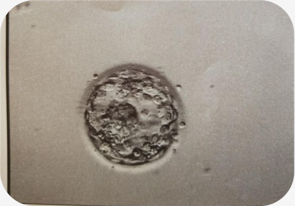 试管婴儿移植用囊胚培养好吗？